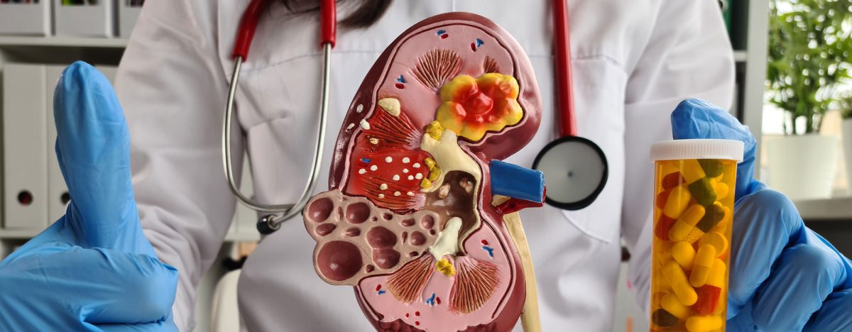 kidney6 kidney6