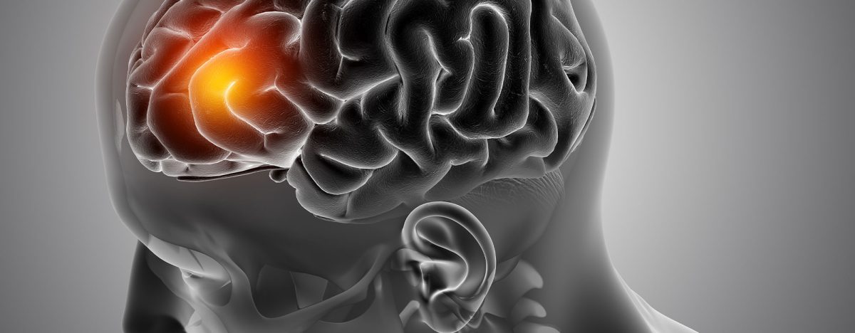 neurologji neurologji